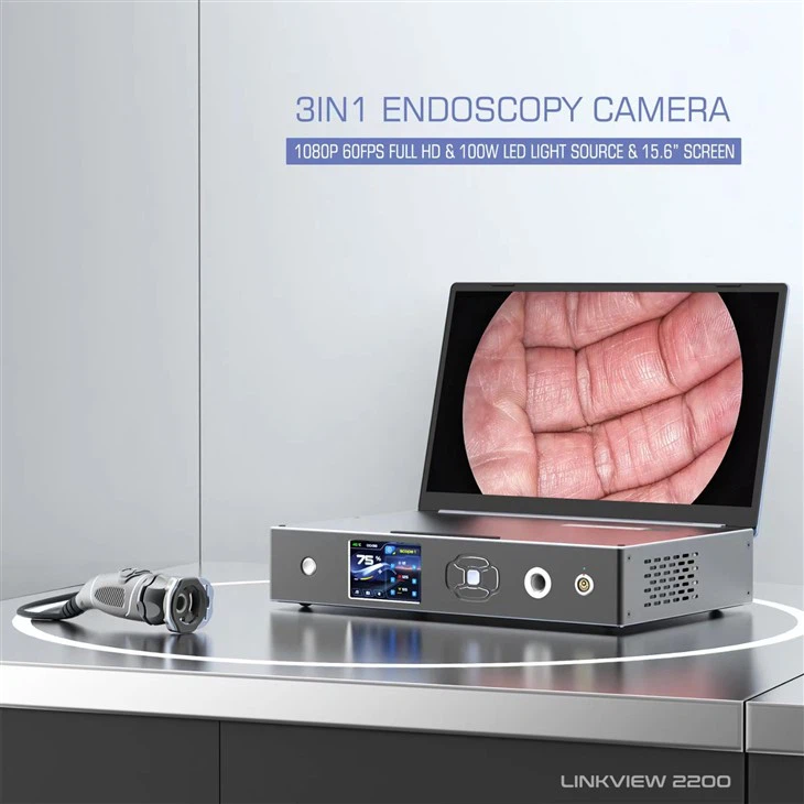 3-in-1 Laparoscopic Hysteroscopy Camera